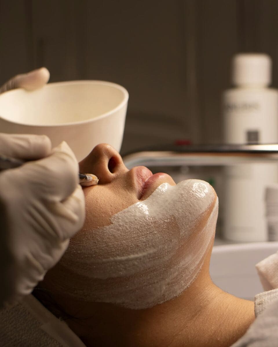 Carbon Laser Facial