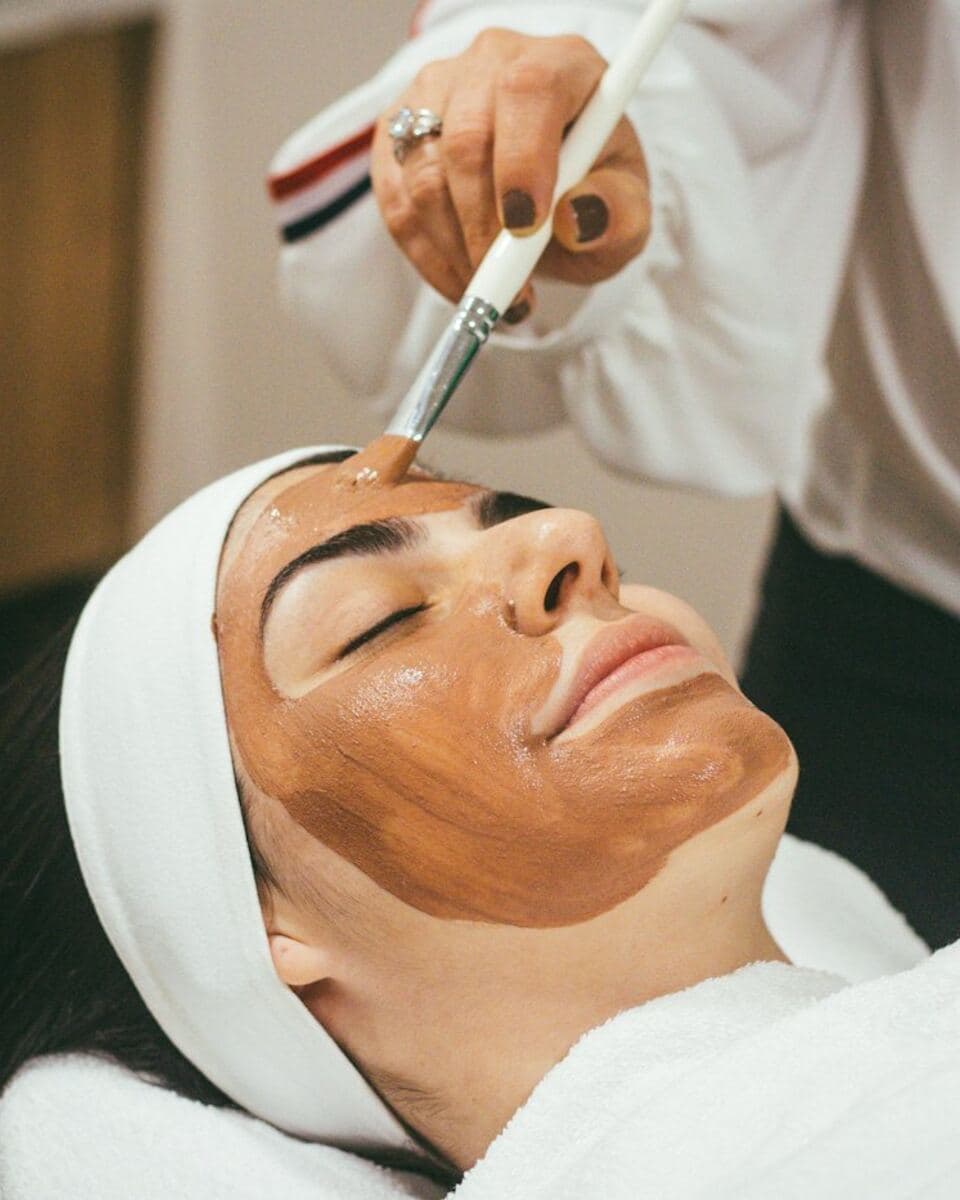 Chemical Peel