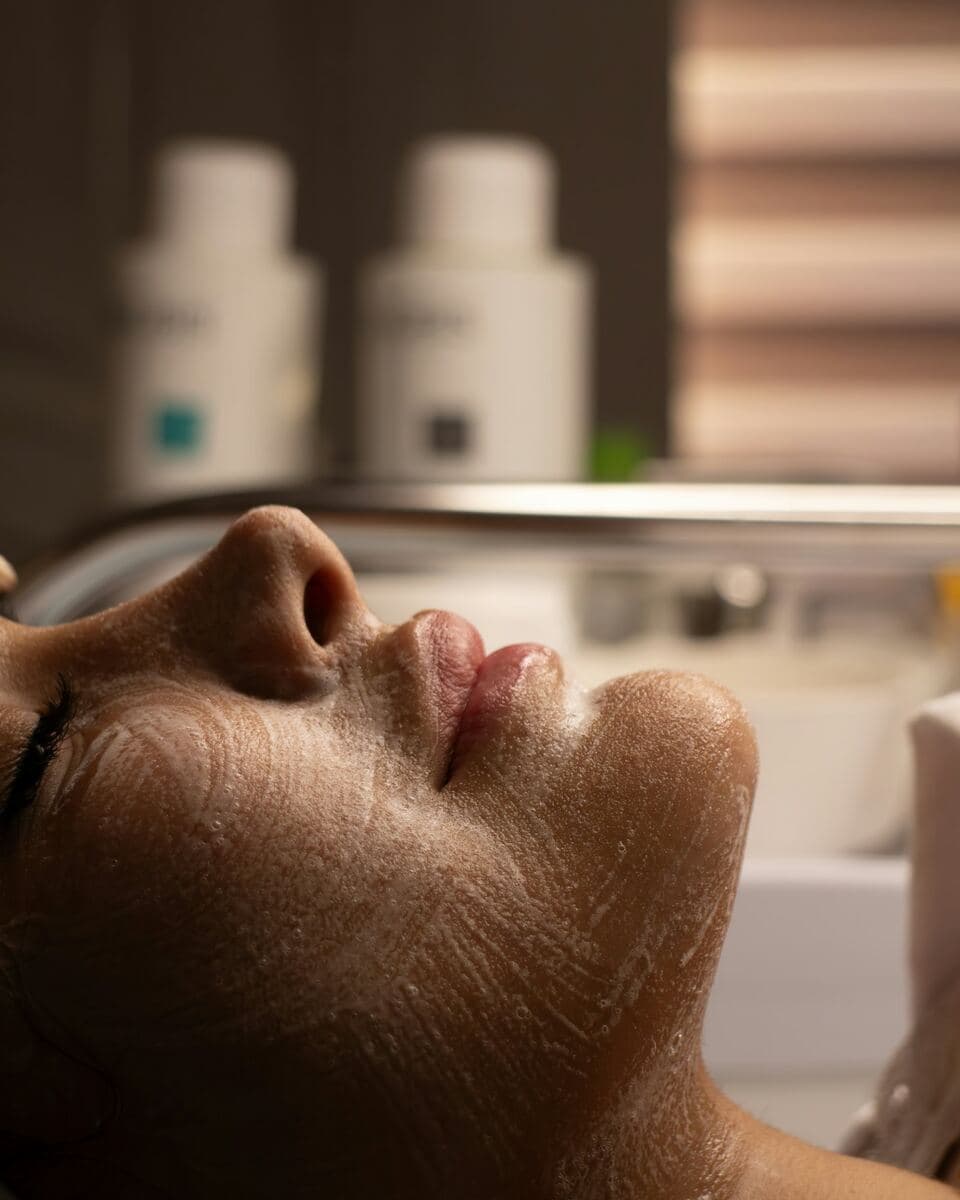 Microneedling